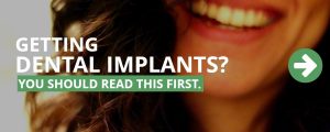 Getting Dental Implants? You Should Read This First.