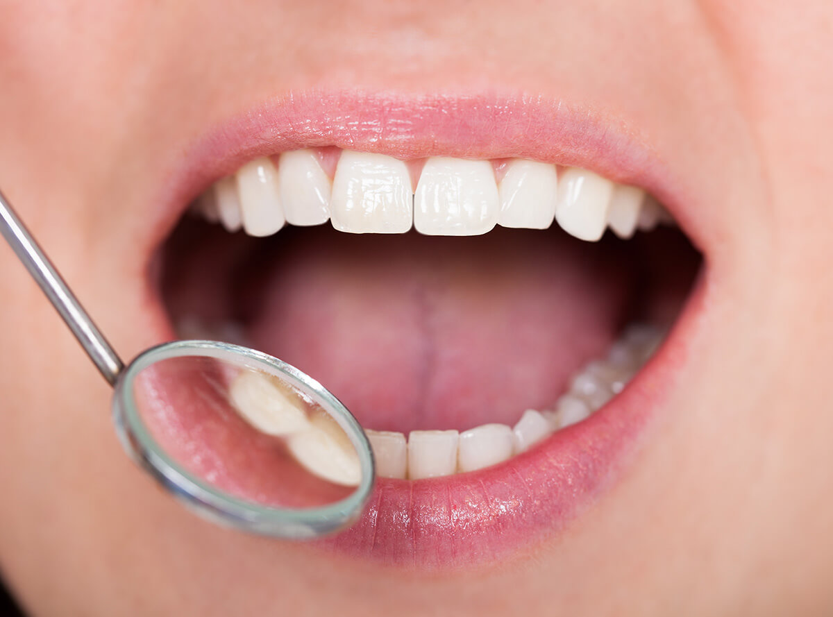 Safe Silver Mercury Fillings Removal In Clearwater