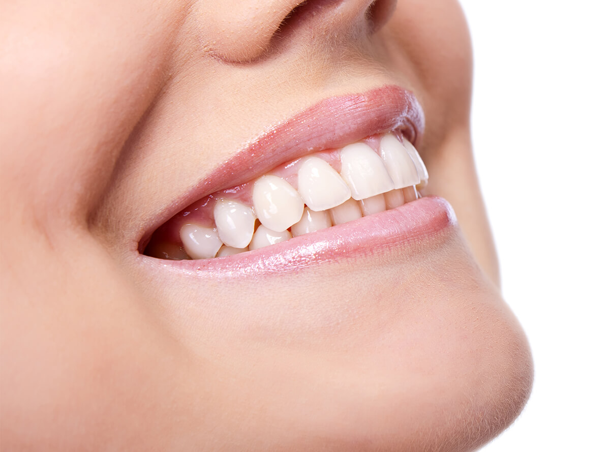Laser Gum Treatments in Clearwater FL Area